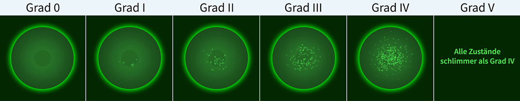 Sicca | Staining graduieren